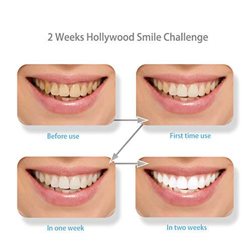استمتع بابتسامة هوليود مع شرائح كريست لتبييض الأسنان